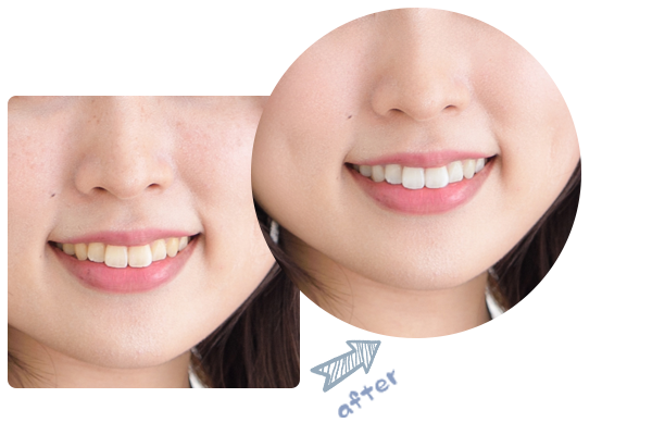 パーツレタッチ